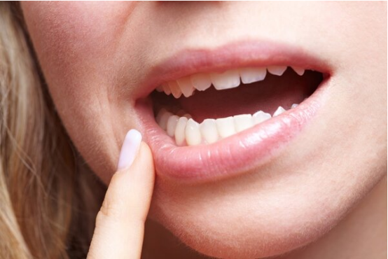 牙齿松动、牙龈肿胀不是小问题，还有可能是牙龈癌！