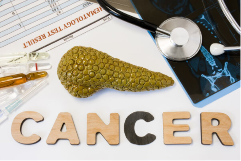 胰腺癌并非一出现就是晚期！5个异常，你可能错过了